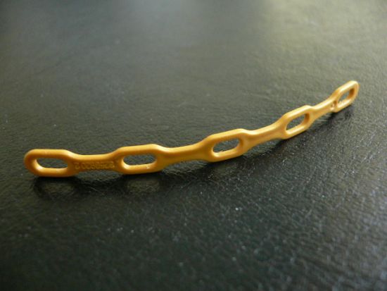 Klemmleiste-Baldachin Klemmleiste-Baldachin