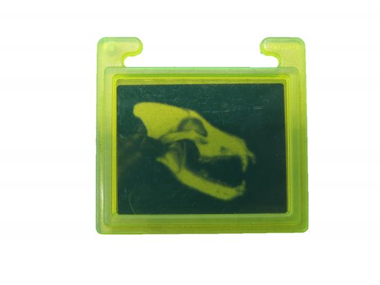 Röntgenbild Röntgenbild