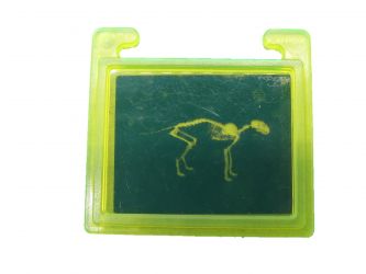 Röntgenbild Röntgenbild